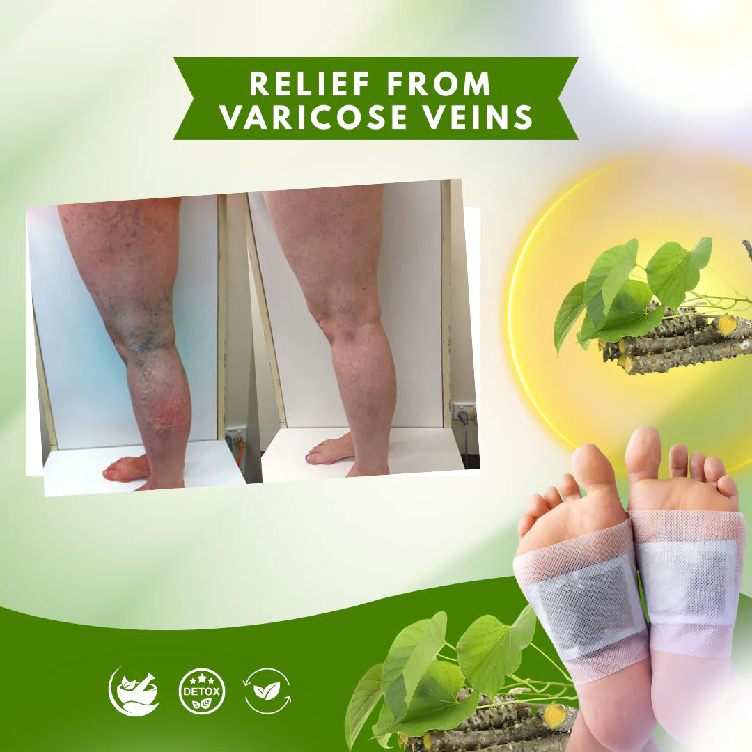 Herbal Giloy Detox Foot Patches Buy 20 Get 20 (Pack of 40)